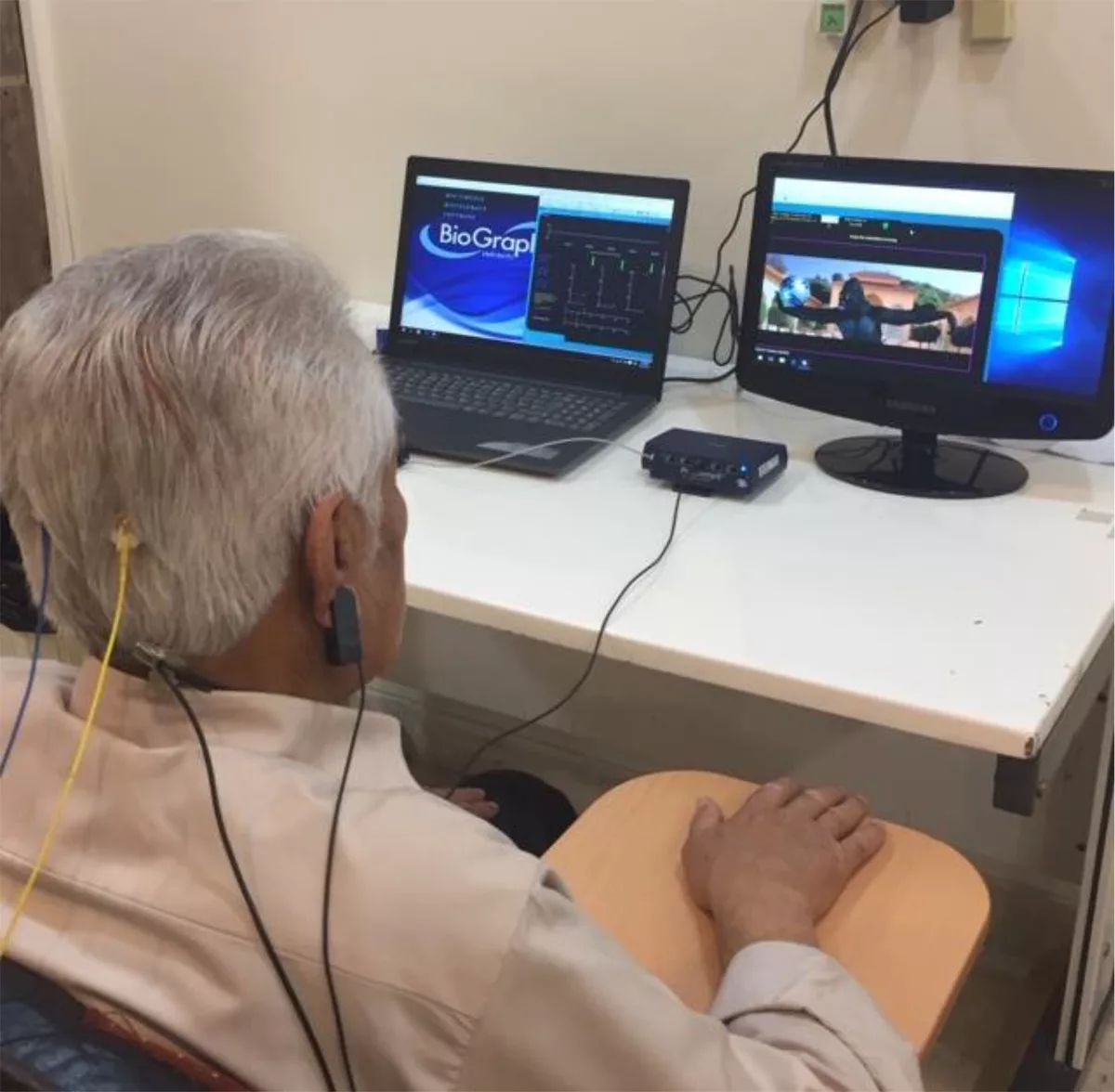 Mild Cognitive Impairment and Neurofeedback